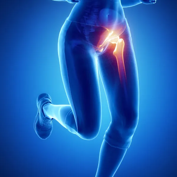 Травмы тазобедренного сустава