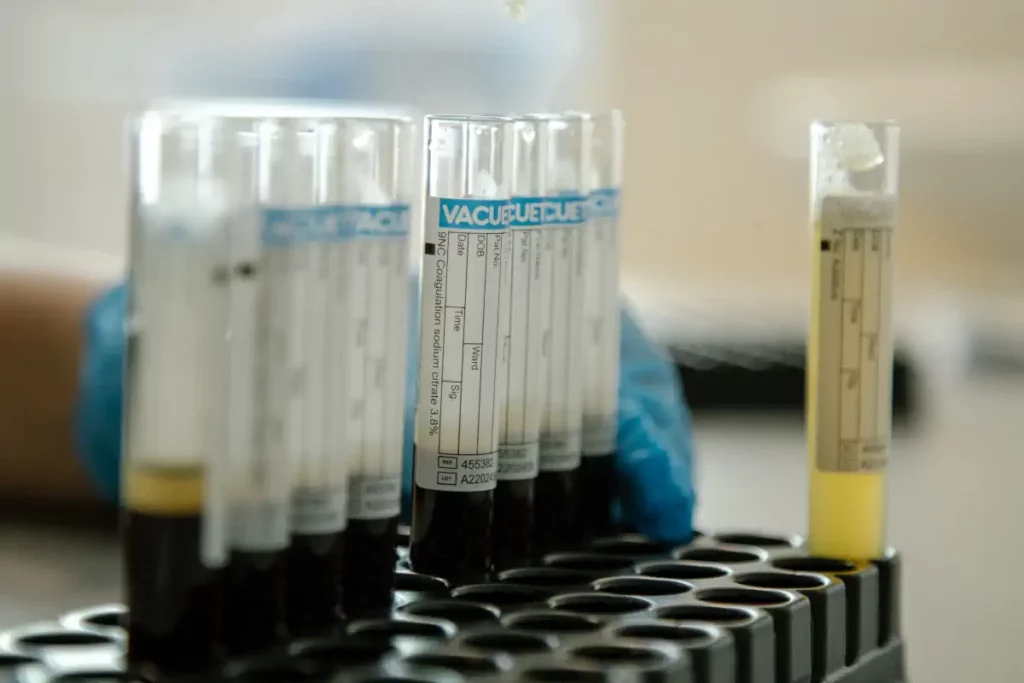 PRP терапия для суставов — регенеративная медицина для восстановления